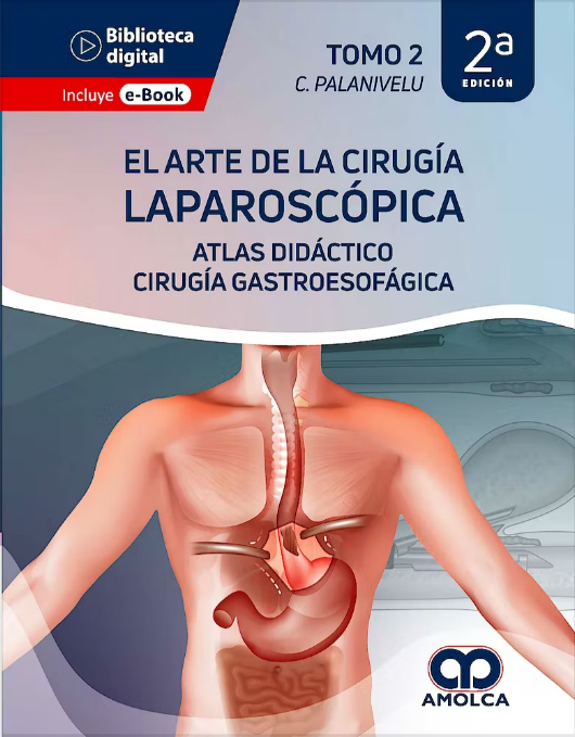 El Arte de la Cirugía Laparoscópica Tomo 2: Atlas Didáctico. Cirugía Gastroesofágica